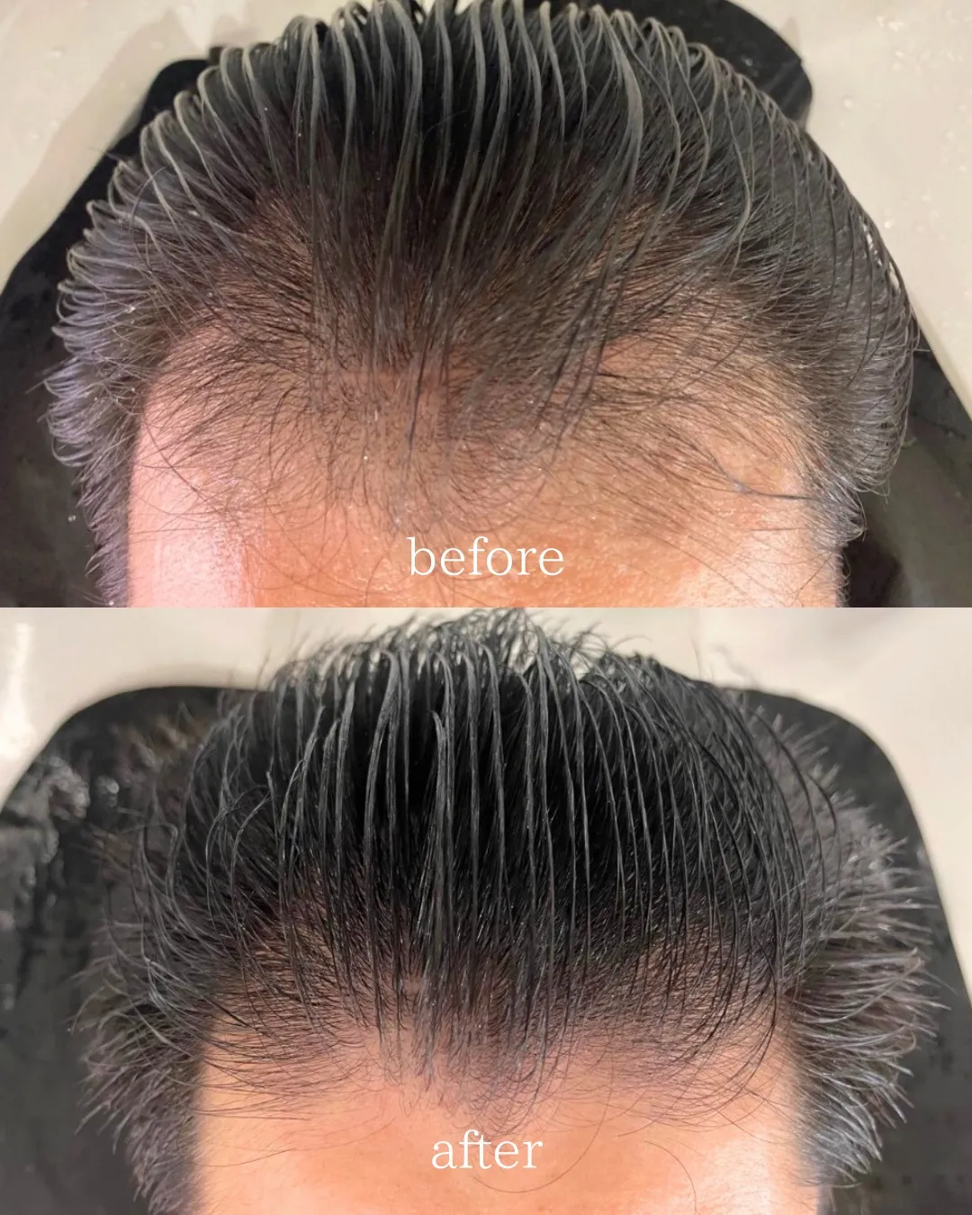 髪の老化予防は簡単なことから始められる!