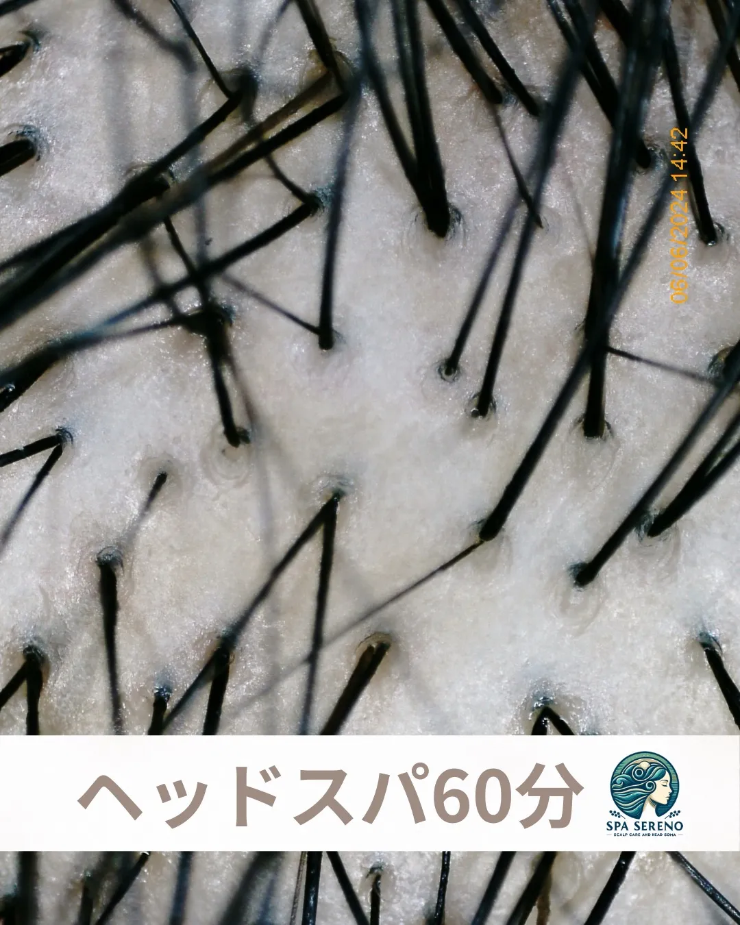 一目でわかる毛穴の変化